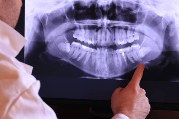 Best Emergency Denture Repair in Decatur, MI